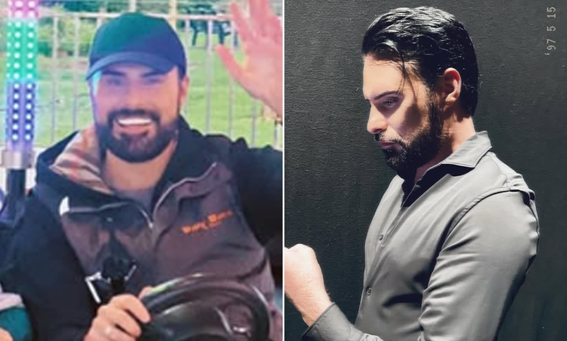 Rylan Clark’s Revealed ‘Invasive Tweakments’ Show Off Results