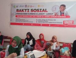 14 Anak Jalani Operasi Bibir Sumbing di RSUD Datu Beru Takengon