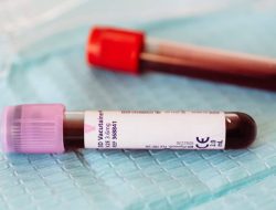 The world’s rarest blood type defies belief – only 3 people have it
