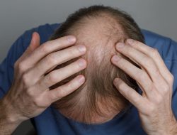 Health Officials Warn: Common Hair Loss Pills May Cause Depression