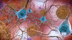 Early Alzheimer’s risk detected by blood test – how accurate?