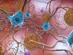 Early Alzheimer’s risk detected by blood test – how accurate?