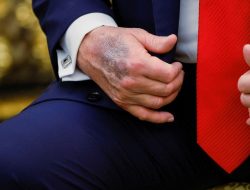 Social Media Condemns Trump’s ‘Excellent Health’ Claim
