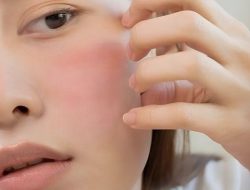 Glowing Tidak? Mungkin Skincare Kamu Sedang Bertengkar di Wajah
